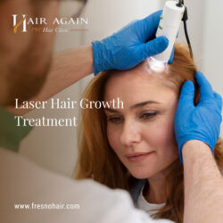 laser hair growth treatment2(1)