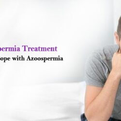 Azoospermia Treatment (1)
