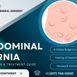 Abdominal Hernia Symptoms & Treatment Guide