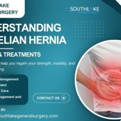 Understanding Spigelian Hernia Causes & Treatments