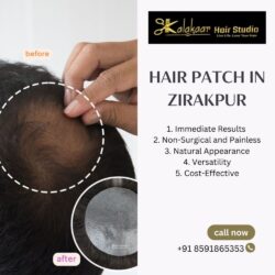 Hair Patch In Zirakpur