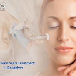 Best Burn Scars Treatment in Bangalore