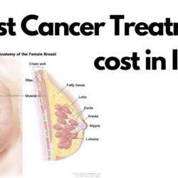 Breast Cancer Treatment in India