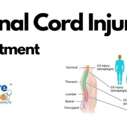 CureIndia for Spinal Cord Injury Treatment in India