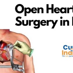 Open Heart Surgery in India