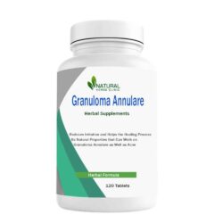 Herbal-Supplements-for-Granuloma-Annulare-min