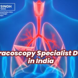 Best-Thoracoscopy-Specialist-and-Expert-Doctor750