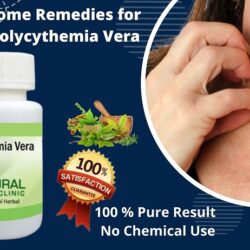 Home Remedies for Polycythemia Vera