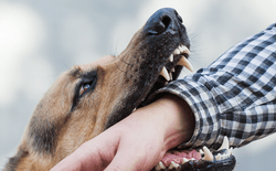 san diego dog bite attorney (3)