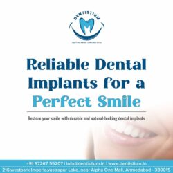 Advanced Dental Implants Solutions at Dentistium, Ahmedabad