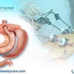 best bariatric surgeon in bangalore (2)