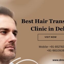 Best Hair Transplant Clinic in Delhi