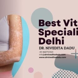 Best Vitiligo Specialist in Delhi