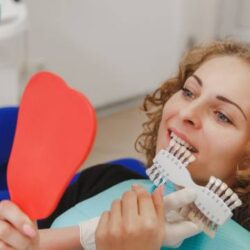 Dental veeners in delhi