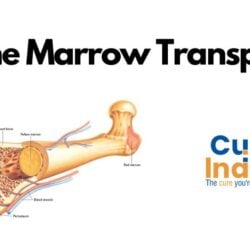 Bone Marrow Transplant in India