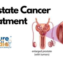 Prostate Cancer Treatment in India