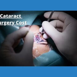 Cataract-Surgery-cost