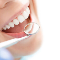 amalgam-free-dentistry-1