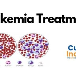 Best Choice for Leukemia Treatment in India