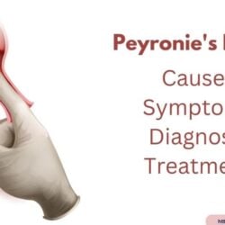 Peyronie's Disease