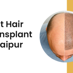 Best Hair Transplant in Jaipur (2)