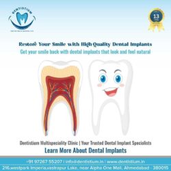 best dental implants treatment in ahmedabad