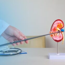 doctor-nephrologist-pointing-fibrous-plague-artery-kidney-mockup-his-desktop_132310-9257