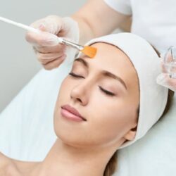 chemical peels culpeper