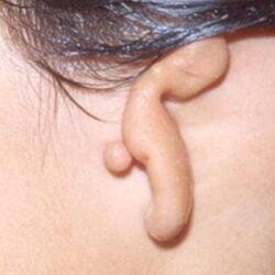 ear