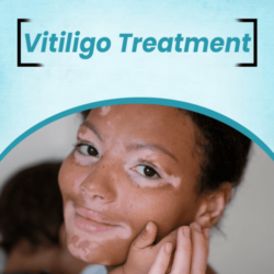 Vitiligo (6)