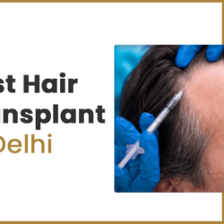 Best Hair Transplant in Delhi (1)