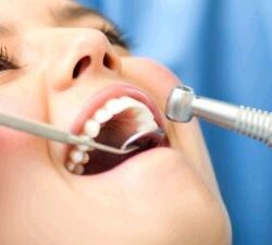 Unmatched Quality Dental Implants in Melbourne for Superior Results