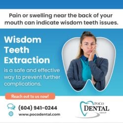 Wisdom teeth extraction