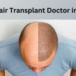 Best Hair Transplant Doctor in Jaipur