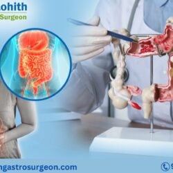 best gastroenterologist in Bangalore