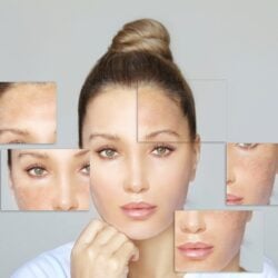 Skin-lightening-and-pigmentation-treatment