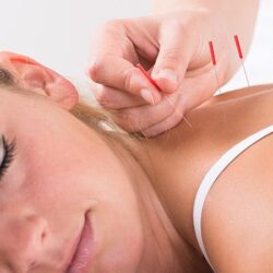 acupuncture-treatment-960x450