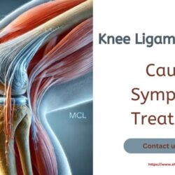 Ligament Injuries